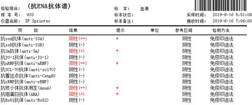 如圖2 圖2 結合上圖提示抗 ssa抗體陽性,目前認抗ssa抗體與乾燥綜合