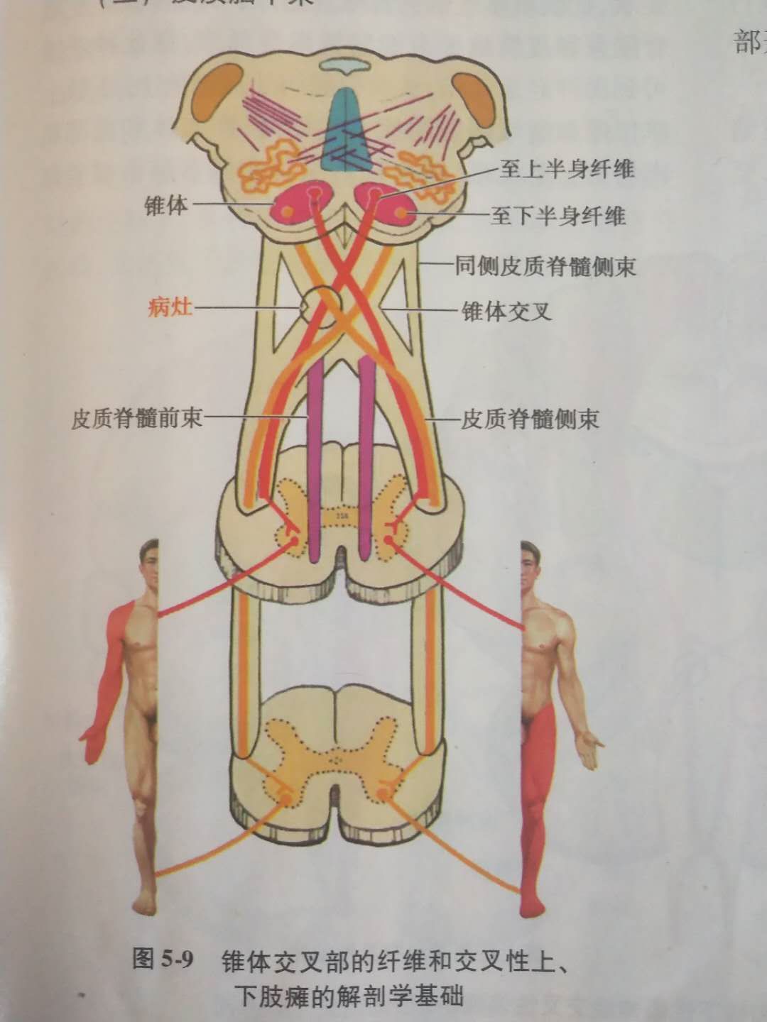 六,延髓到脊髓内传导上面已经说了,皮质脊髓侧束位于脊髓后内侧,上肢