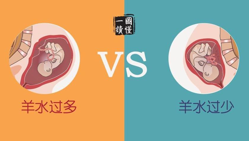 羊水是胎儿的尿吗 来自搜狐网