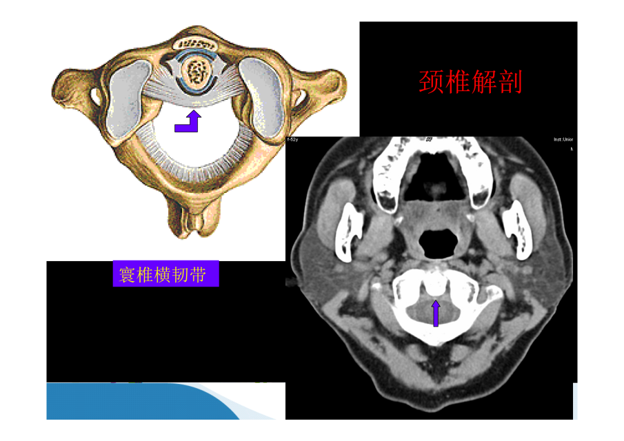 神级别的颈椎影像图谱