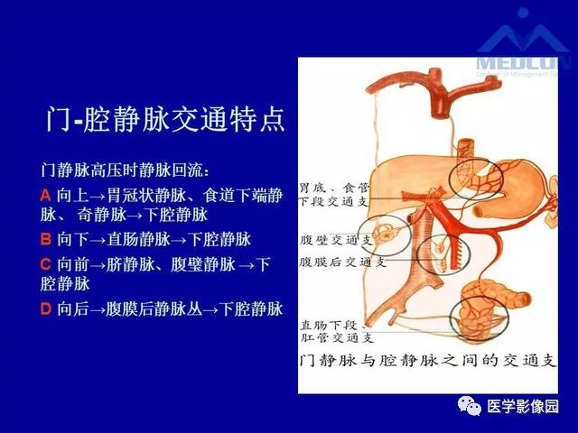 门静脉高压分型及影像学特征
