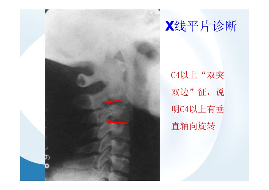 神级别的颈椎影像图谱