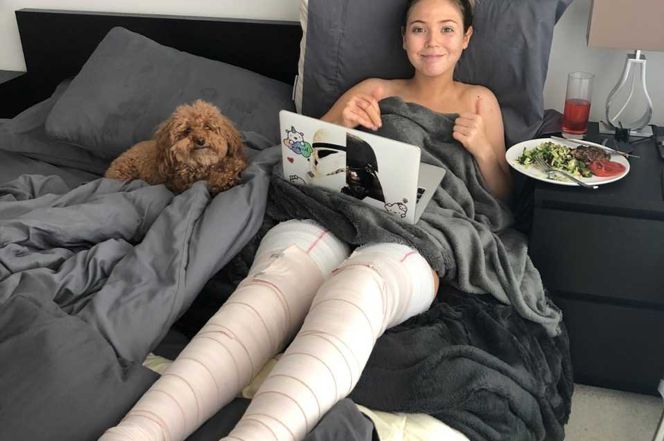 摄影师玩火烧伤模特_jansen