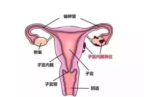 卵巢位置在哪图片