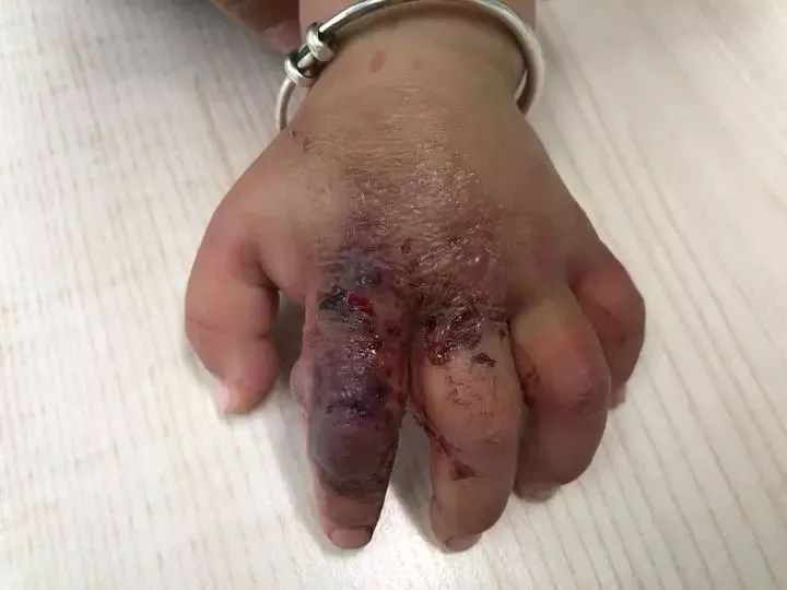 家人:再也不敢了!这次真的后悔了