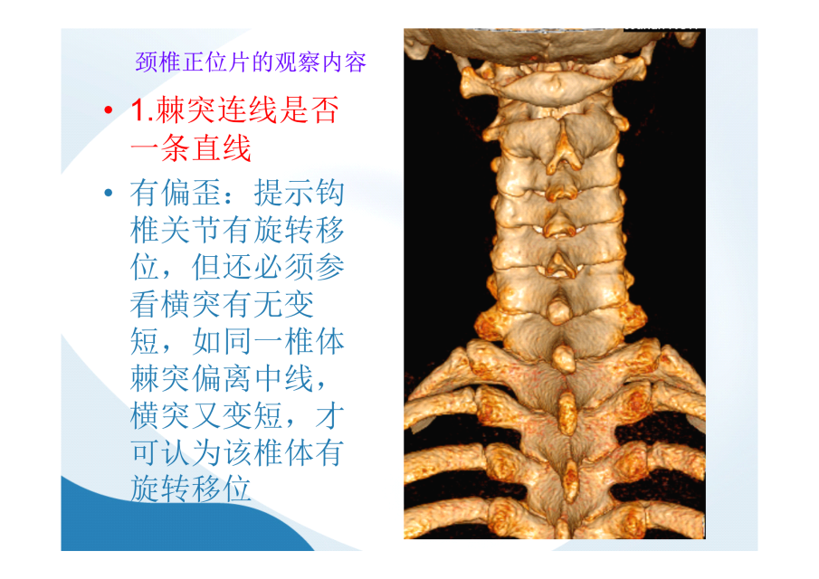 神级别的颈椎影像图谱