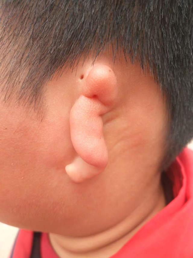 原创深圳流水线工人自学雕刻,帮贫穷的小耳症者做1000多个"义耳"