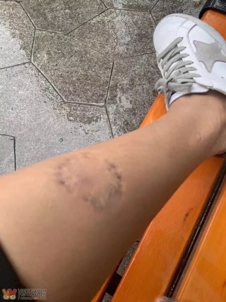 人咬人宜宾一女子遛狗不牵绳遭质疑后女子直接咬了路人一口