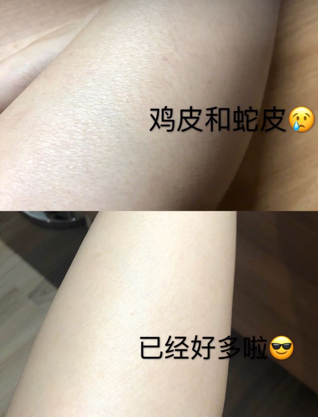 鸡皮肤变褐色(鸡皮肤颜色变化过程)