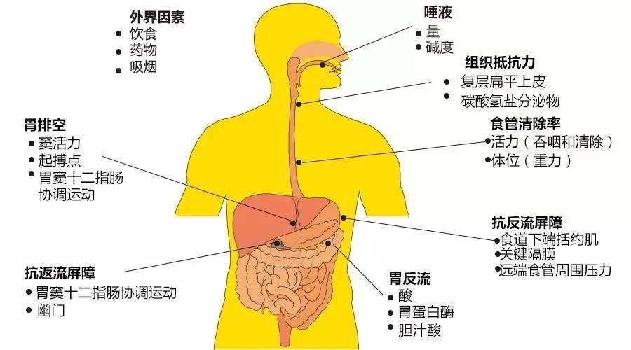 【医学科普】警惕胃食管反流病