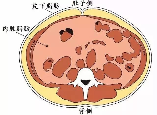 內臟脂肪就是長在人體內臟,特別是腹腔內,皮下脂肪過多導致的肥胖是