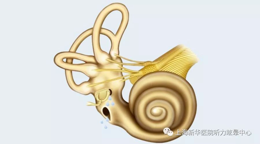 即内耳的外淋巴液通过外淋巴瘘
