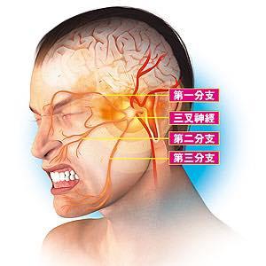 三叉神经痛患者面对手术风险竟然这么说