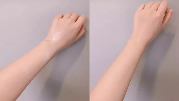 鸡皮肤多少天洗一次澡(鸡皮肤多少天洗一次澡比较好)