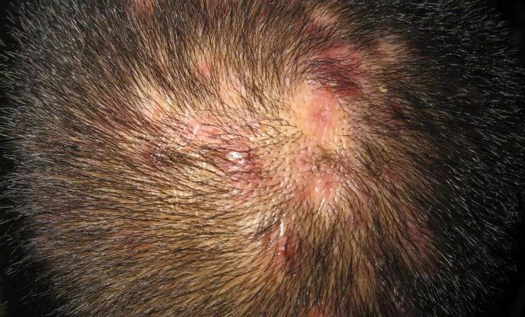 鸡皮肤和脱发有关联么(脱毛膏对鸡皮肤有影响吗)