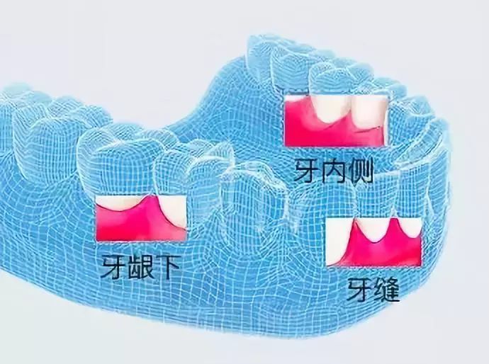 专业牙医都在推荐使用,牙齿的脏东西,都被它喷出来了!