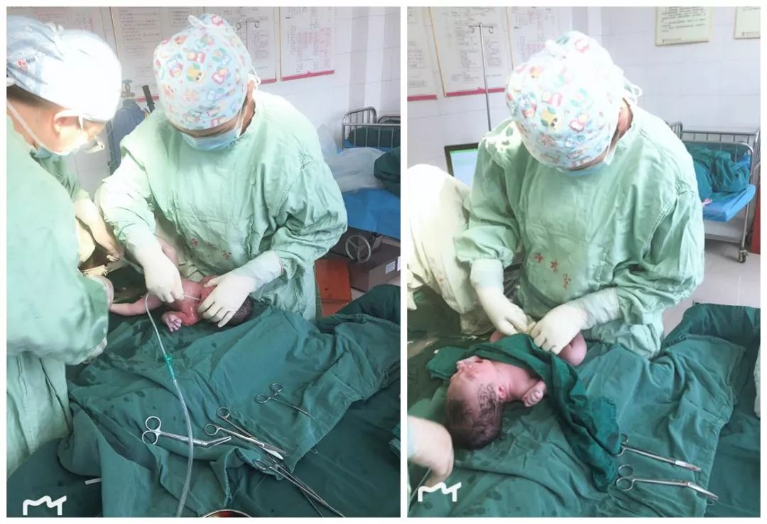 直击分娩现场│公布孕妈们超想看的7大分娩细节