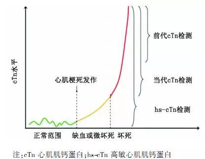 超敏肌鈣蛋白的臨床意義