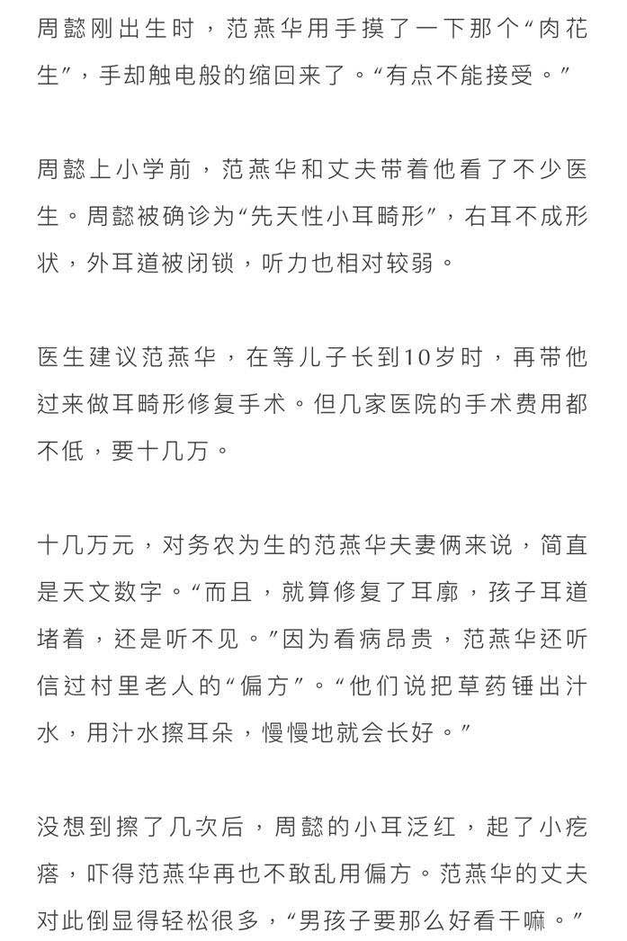 范燕华从没见过这样的耳朵,左耳是健康,完整的,但右边原本应该长着