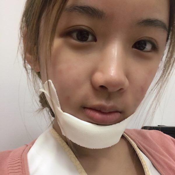 现在没人敢再说我了!_下巴