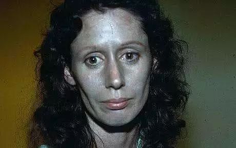 一旦身体3处发黑十有八九是癌症找上门了希望你一个没有