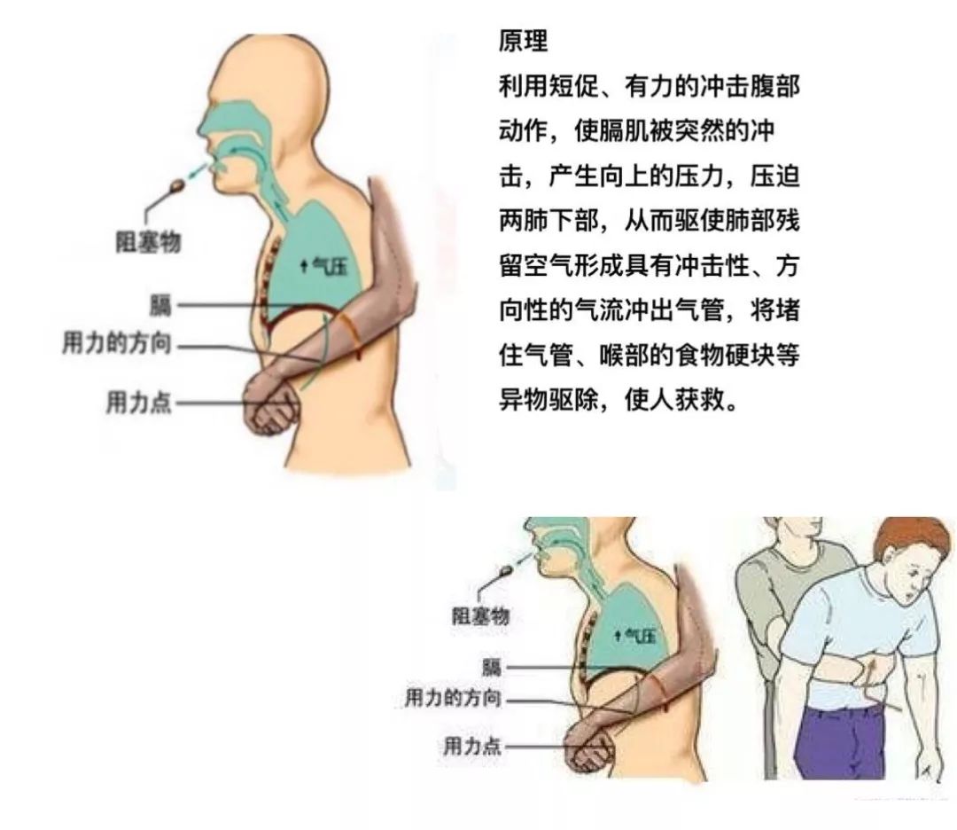 传递生命的拥抱