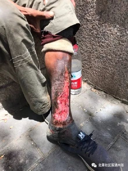 用血肉模糊似乎都难以形容他腿上的伤口,凹下去的那一片已经看不到皮