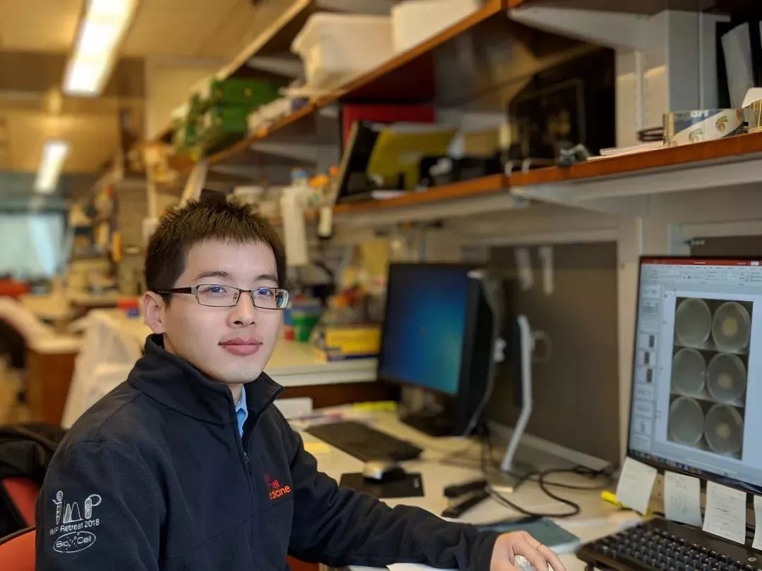 苏宏伟在南非做了一年实验后我要与结核病硬磕下去