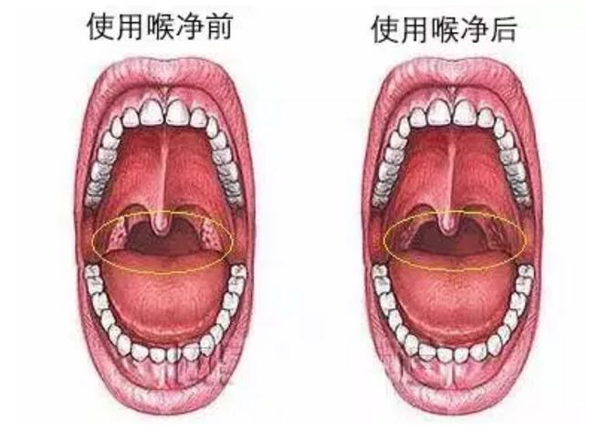 9%,3秒喉咙就舒服!