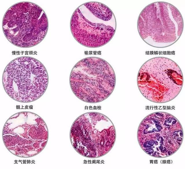 病理科医生的病理梦万荣县人民医院病理科