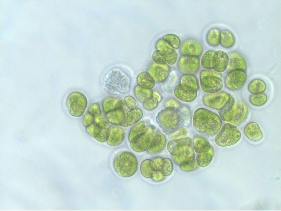 (2)有益藻类如硅藻,小球藻和金藻过少,导致蓝藻成为优势种发生水华;(1
