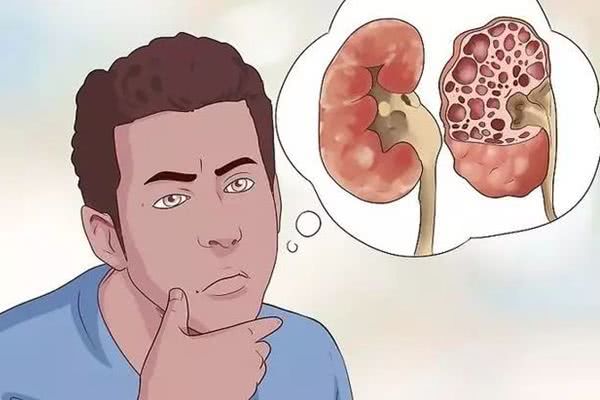 痛风不仅仅是痛了你的关节还有你的肾