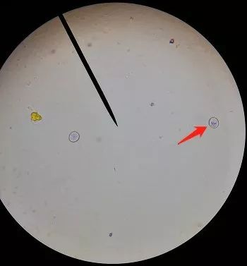 显微镜下球虫图片