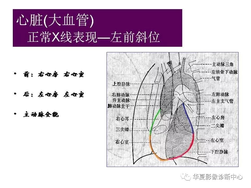 心脏大血管的影像学解剖
