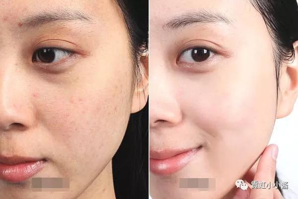 皮肤松弛下垂——哀怨愤世