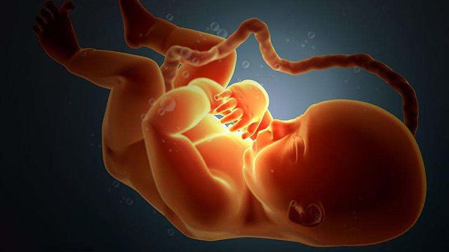 胎儿绕颈图片