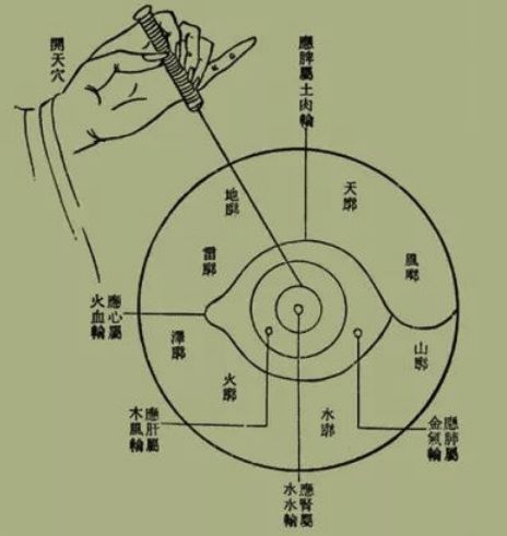 唐代我国已经有条件开展基础的白内障治疗手术,这被称作"金针拨障术"