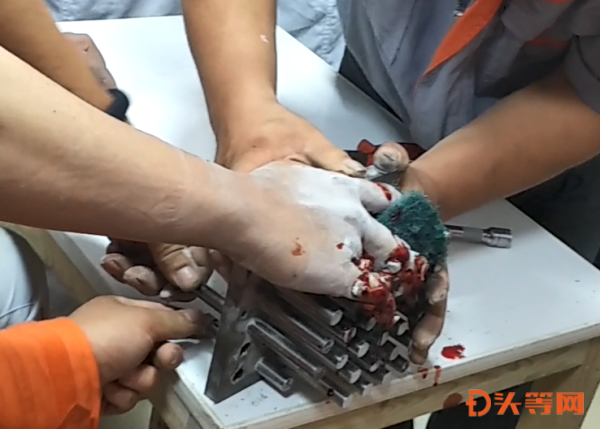 危险!张店一女职工被模具卡手,消防员30分钟解救