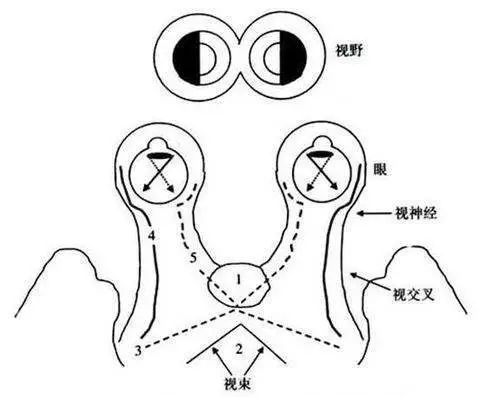 空蝶鞍是什么意思图片