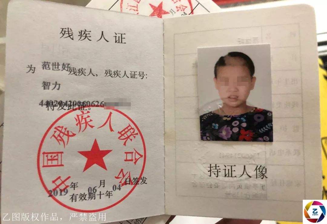 13岁智障少女意外怀孕站着生产孩子摔成重伤不知娃生父是谁