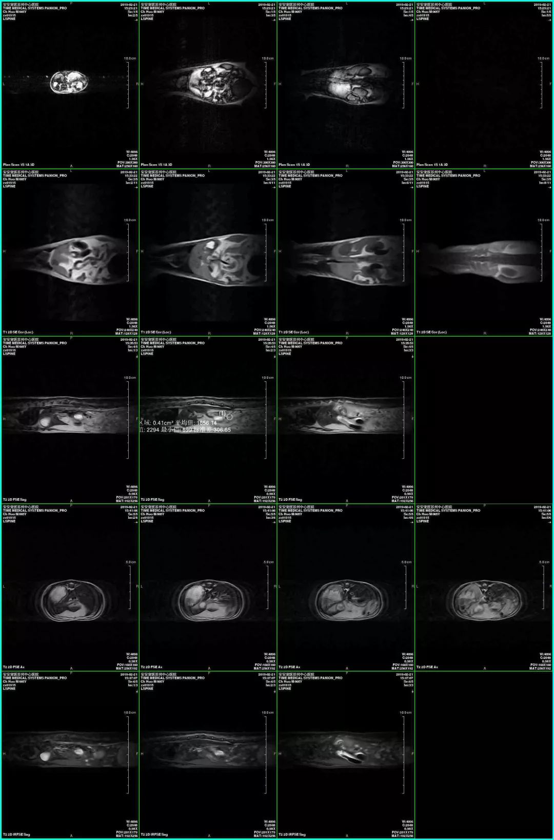 安安宠医苏州中心医院引入小动物核磁共振(mri)技术