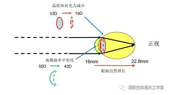 原来角膜塑形的近视控制效果比想的还要高!_屈光度