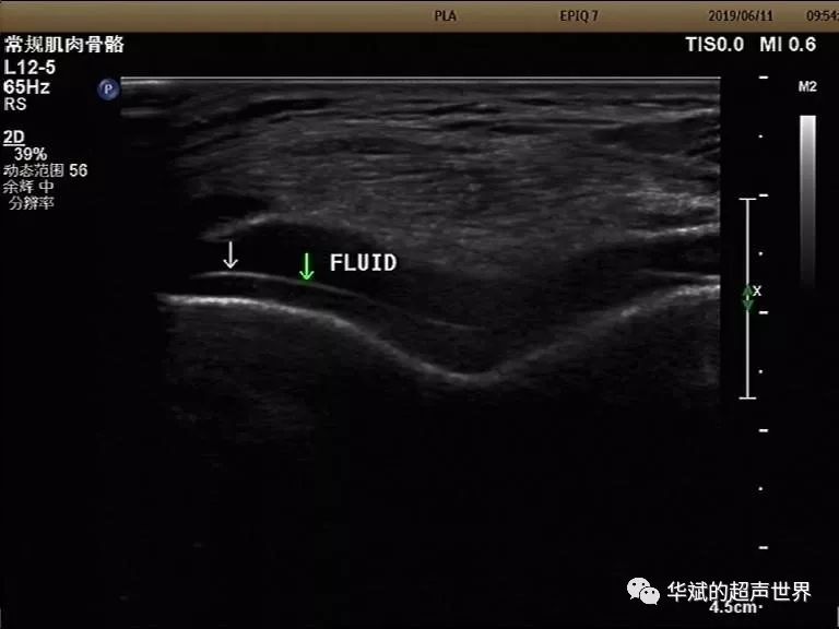 图片分享真假双轨征
