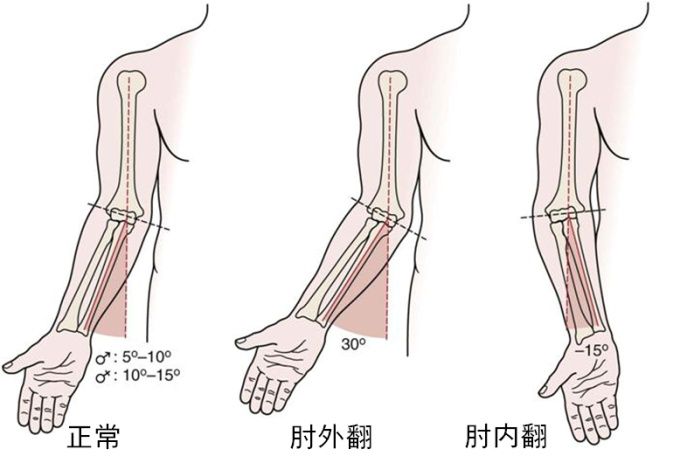 从医学的角度胳膊肘稍向外拐过度向外或向内拐可能有问题