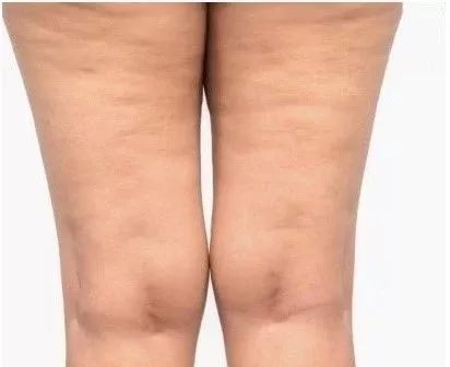 二字顶流美少女暴瘦20斤竟被爆去韩国吸脂