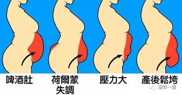 怀孕加上骨盆前倾简直是灾难型体态!