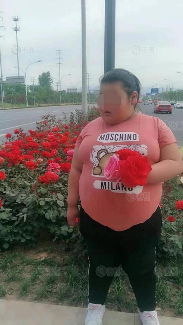 212斤12岁小女孩手黑脸黑是肥胖导致的黑棘皮病