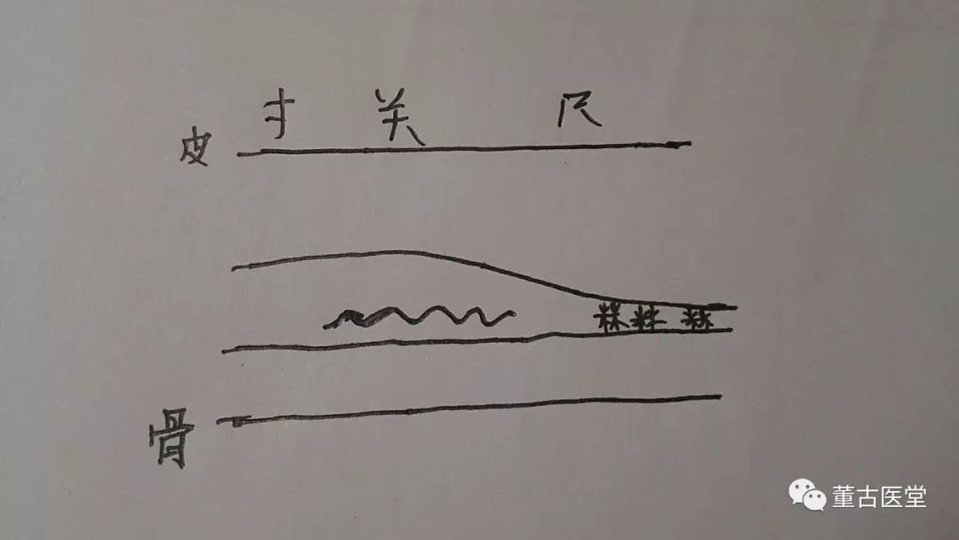 诊脉双关脉沉滑,双尺脉细弦.舌水滑舌尖红.