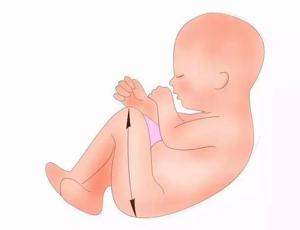 胎儿股骨,就是宝宝的大腿骨,是胎儿最易识别的长骨.