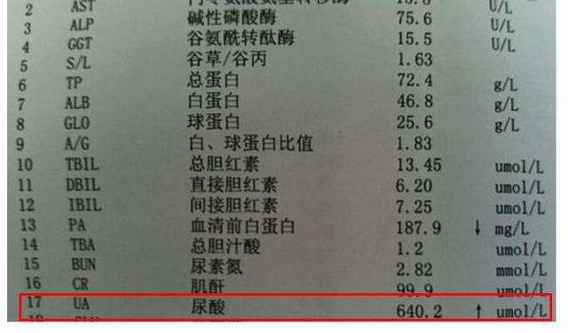 医生介绍评价又有效的痛风药,吃过的人尿酸都降至正常值